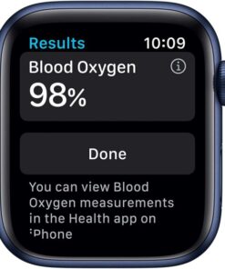 Apple Watch wholesale pallets France