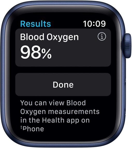 Apple Watch wholesale pallets France